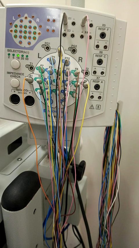 Equipamento de eletroencefalograma utilizado pela NeuroExpert DF